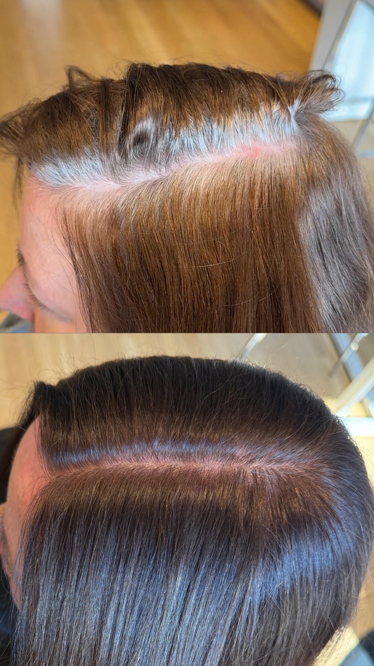 The different types of grey coverage and your options!