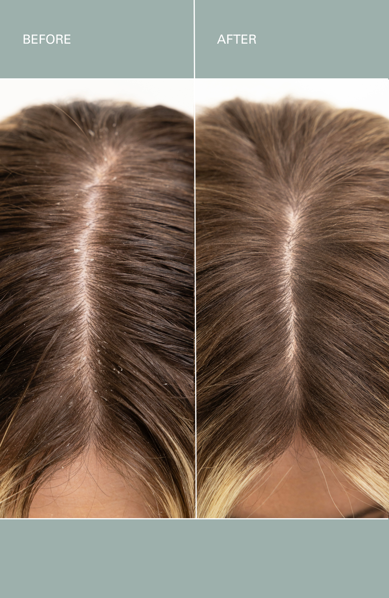 Roz Salt Scalp Scrub